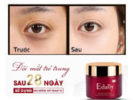 Kem dưỡng mắt Edally Edally EX nhập khẩu khẩu Hàn Quốc - Ảnh 5