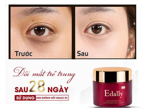 Kem dưỡng mắt Edally Edally EX nhập khẩu khẩu Hàn Quốc - Ảnh 5